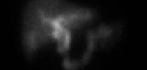 Advanced brain and spine imaging